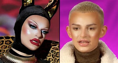 krystal versace surgery